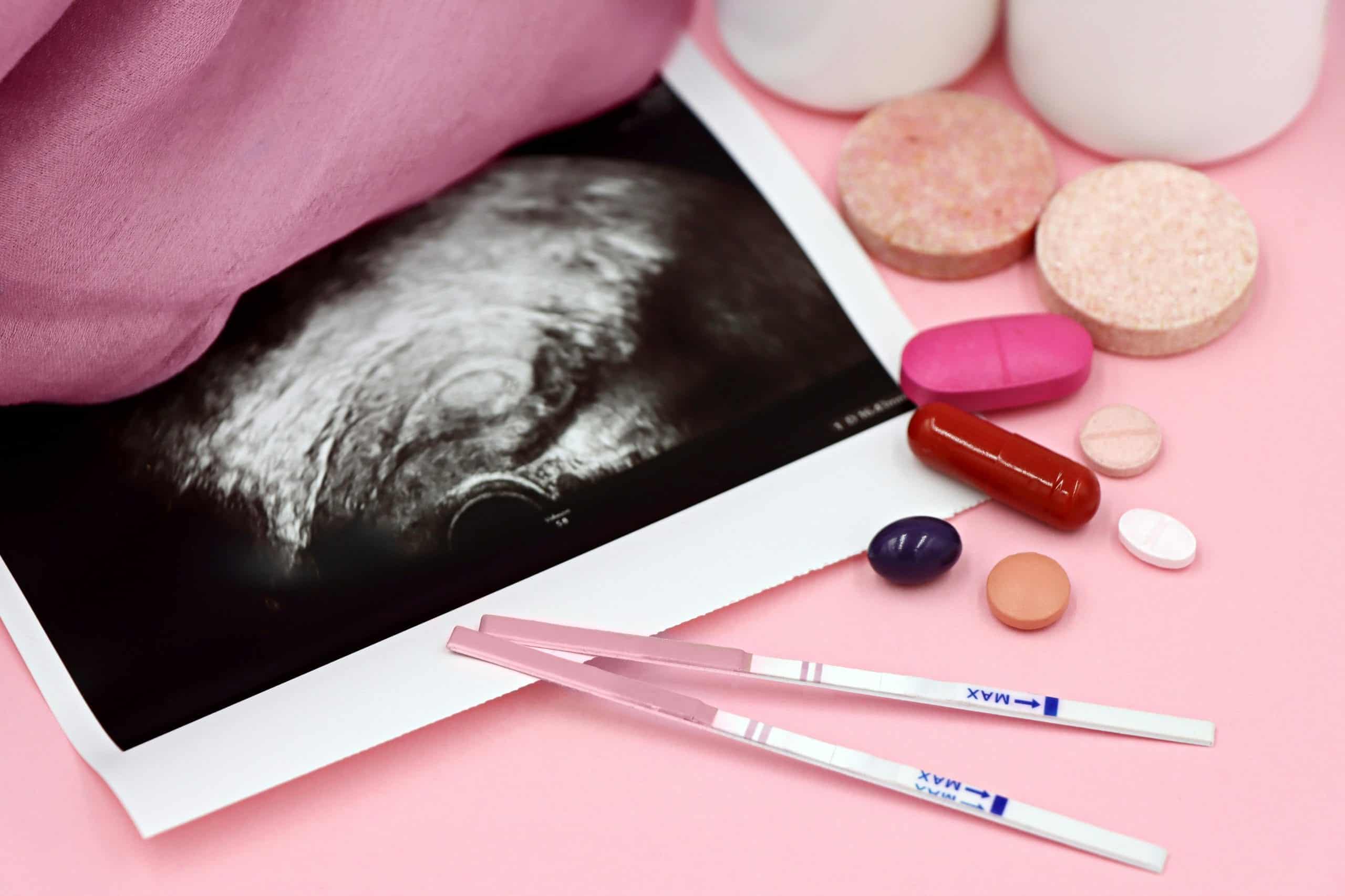 гормональні контрацептиви гормональные контрацептивы hormonal contraceptives